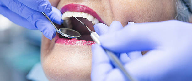 Best Broken or Chipped Tooth Repair in Valle Vista, CA