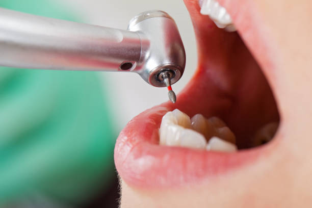 Best Emergency Dental Care for Sports Injuries in Valle Vista, CA